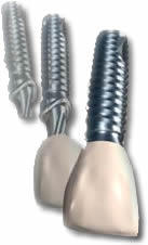 The Dentist @ Milpark, Auckland Park, provides implant, cosmetic and general dentistry services.  We do Tooth Implants